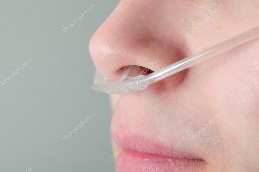 FASMED.CL Cánula Nasal Cánula Nasal Bigotera Adulto | Pack x10 | Oxigenoterapia Médica